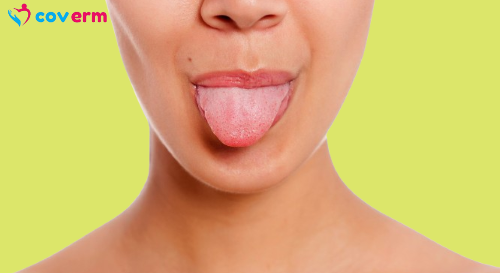 WHAT DOES YOUR TONGUE SAY ABOUT YOUR HEALTH?