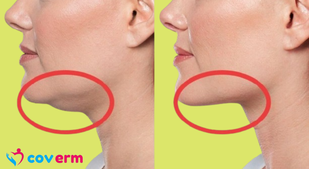IF YOU’RE A WOMAN WITH CHIN WHISKERS PAY ATTENTION. HERE?S WHAT IT MEANS!