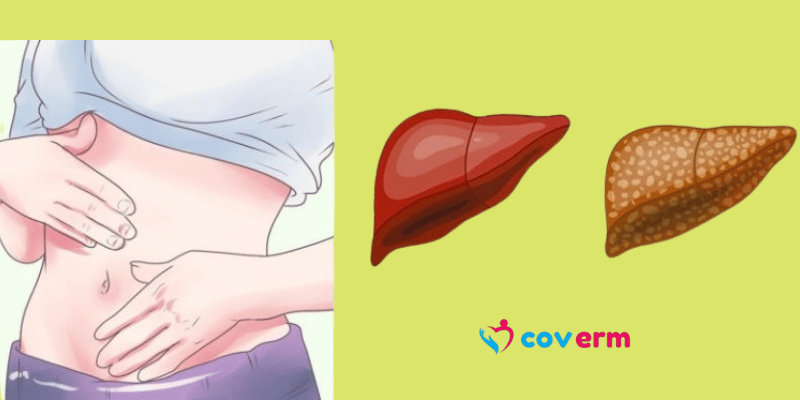 6 Signs That Indicate Your Liver Is Full of Toxins